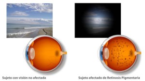retina